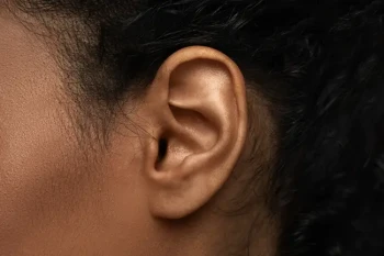 A man's ear after an otoplasty