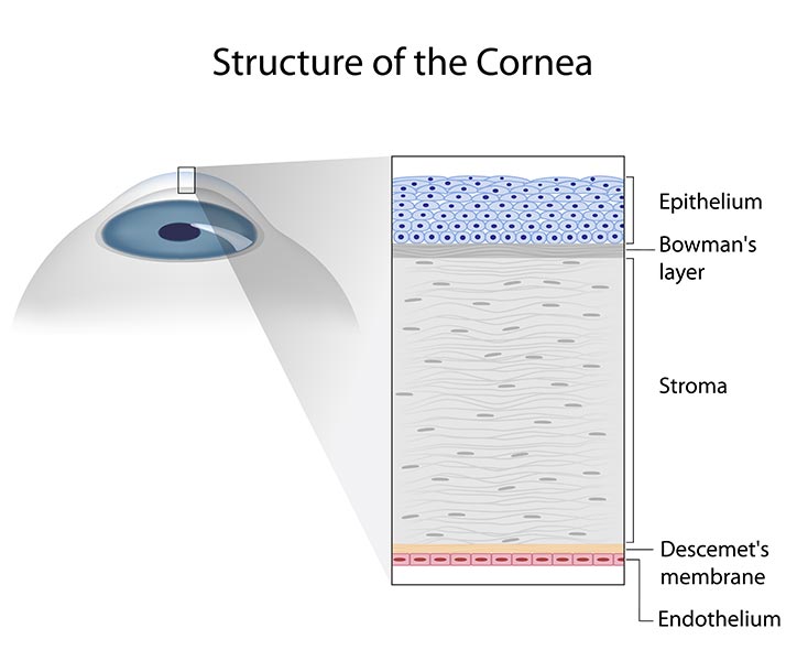 Image of the cornea used by a cornea specialist