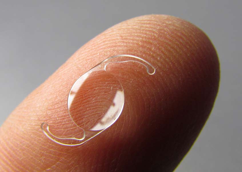 An intraocular lens to be used for refractive lens exchange surgery (RLE)
