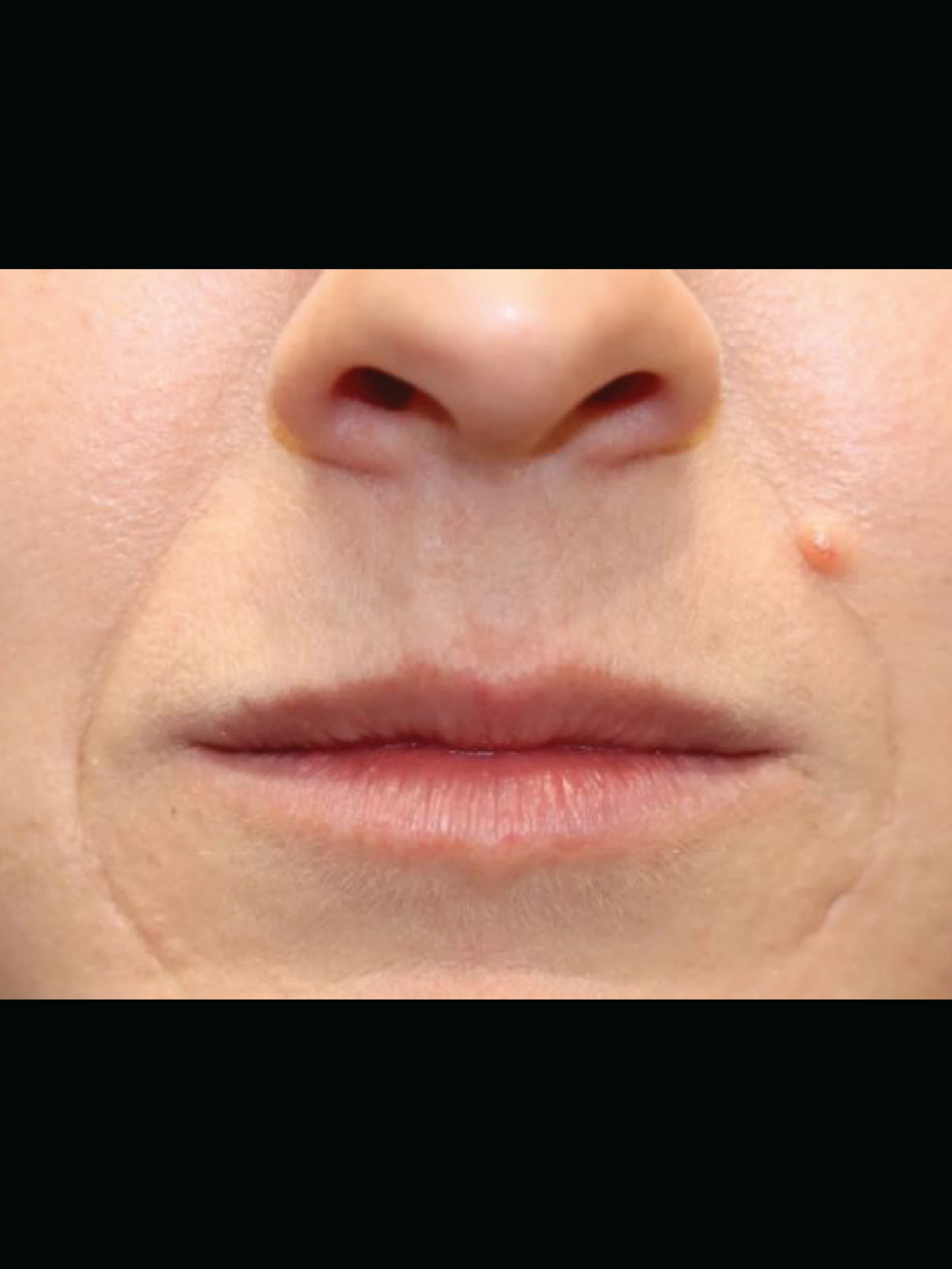 Before and after photos