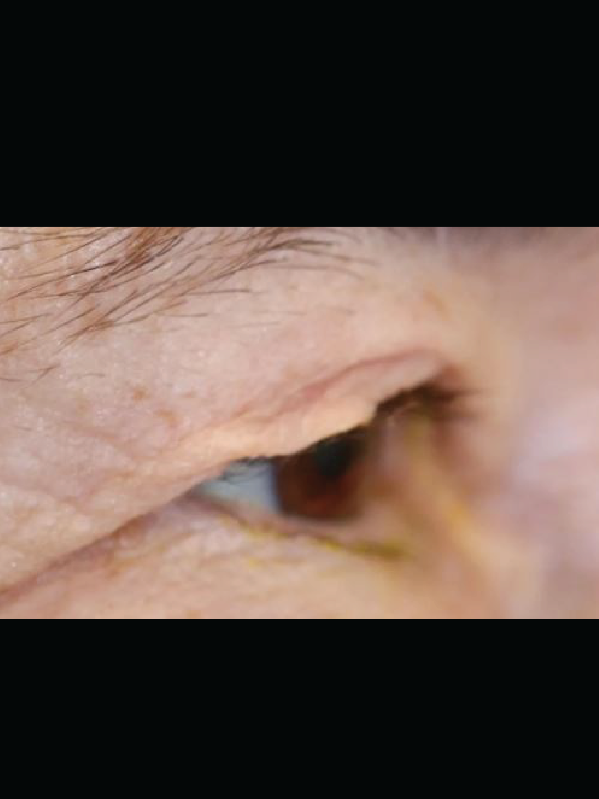 Before and after photos