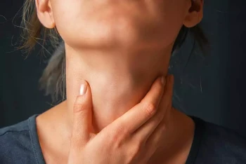 A woman has a throat ulcer or possible sores in throat