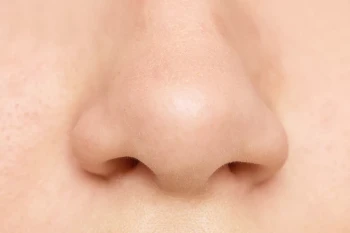 A nose with a deviated septum
