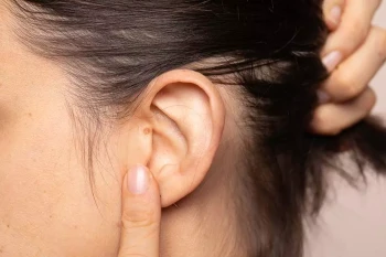 A person points to their ear, where acoustic neuromas would be located