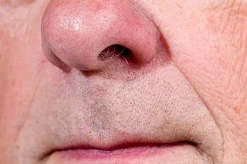 An older person's nose