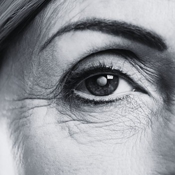 Jane H. cataract patient testimonial for Dr. Chao Li