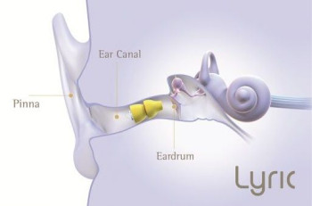 Lyric hearing aid instrument