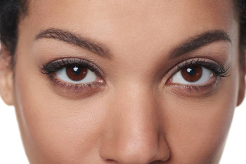 Eyes after Mohs reconstruction.
