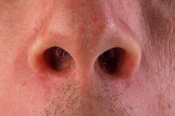 Are Nasal Sprays Safe Ceenta