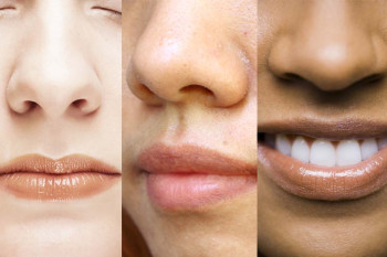 Noses of different shapes