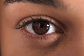 An eye after diabetic treatment