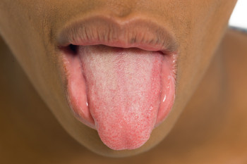 A tongue