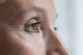 Woman receiving wrinkle and fine line treatment