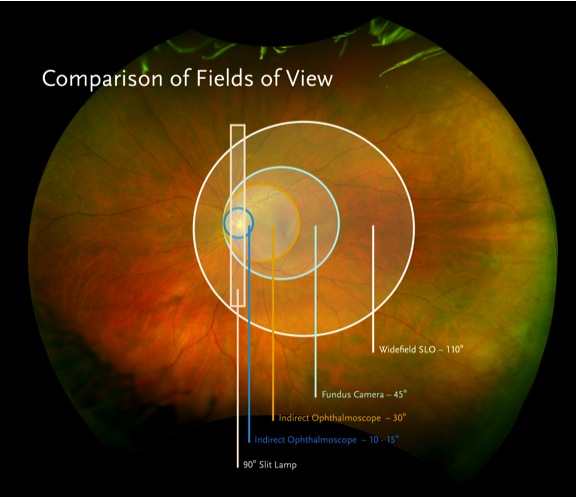 Ultra widefield photography