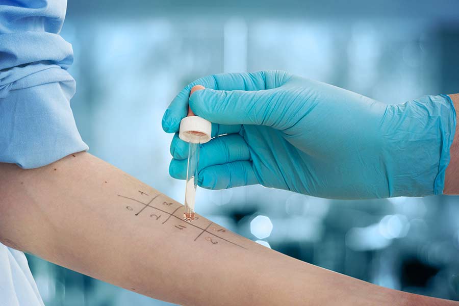 Allergy testing