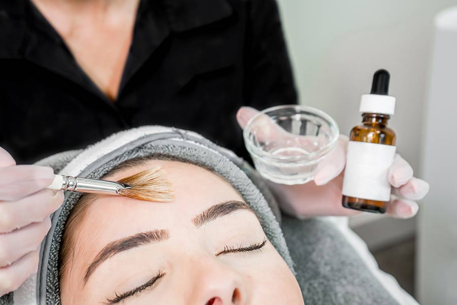 Woman showing a chemical peel and chemical peel benefits