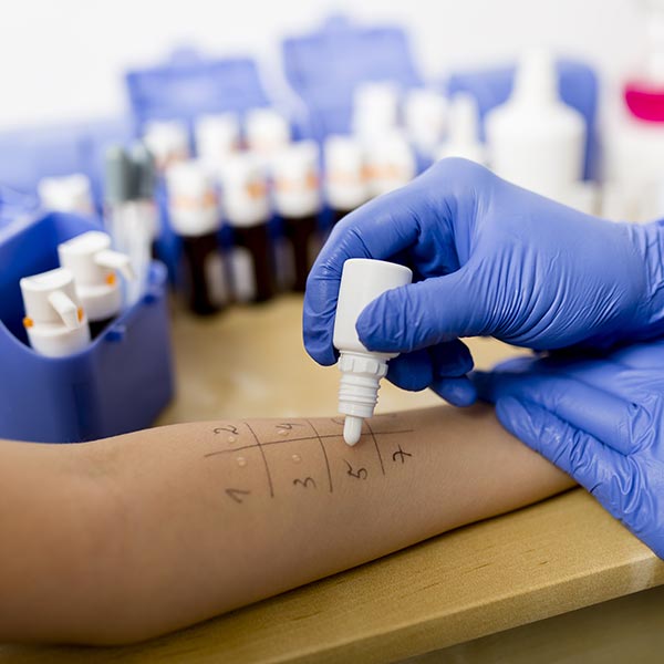 Pediatric allergy testing