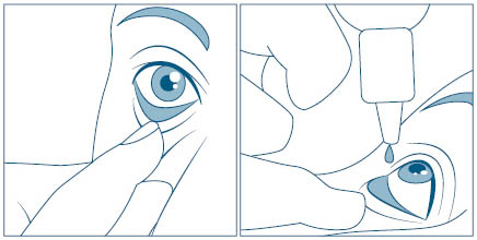 Steps for how to put eyedrops in eye