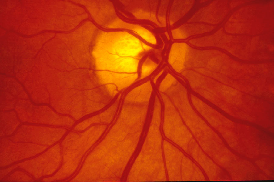 The retina